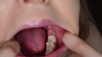 Teeth And Molars Tour Dental History