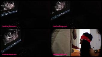 12 Weeks Pregnant Heather Deep Thai Teen Gets Facial After Ultrasound
