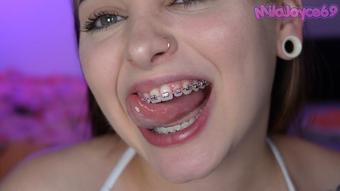 Braces Mouth Tour Vol 2 - August 16, 2023