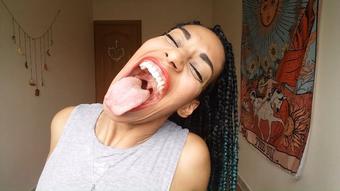 My big mouth and fat tongue - March 18, 2020