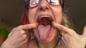 Dent, Mouth, Tongue, Uvula Exam