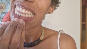 picking and scraping my teeth - August 22, 2022