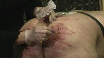 Needles Into The Ass