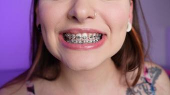 Braces Mouth Tour - May 29, 2023