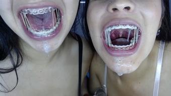 Miaisabella3 Extreme Blowjob With Braces