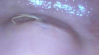 Milly17 Gapig Pussy Endoscope Exploration