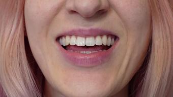 Square Lip Fetish