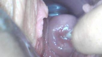 18-01-14 Webcam Teen Milly17 Speculum Examination