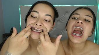 Miaisabella3 Elastic Change Braces Teeth
