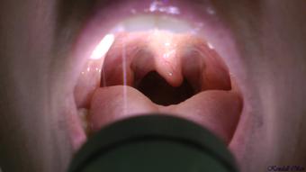Uvula Fetish - February 18, 2016