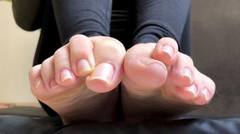 NATURAL OVERLAPPED TOES - February 21, 2025