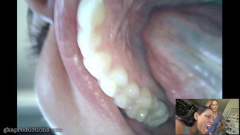 Vanessa Rain & Vika Endoscope Mouth Tour