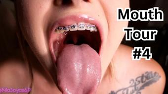 Final Braces Mouth Tour - September 10, 2024