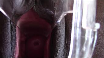 Totalpussy Secretarys Speculum Cervix