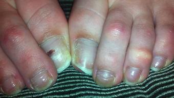RAW NATURAL TOES - February 13, 2024