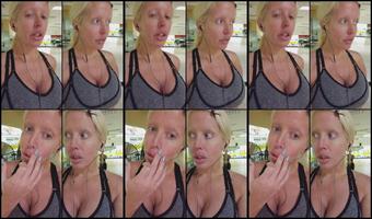 Alurajenson2011 10 05 2017 1367913 I Figured Out How I Bruised My Face Hehehe
