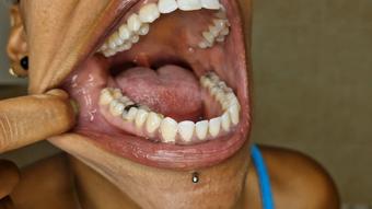 Mouth tour yellow teeth - August 25, 2023