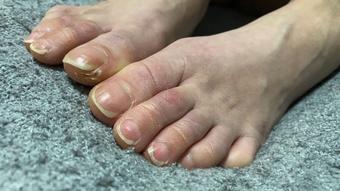 PEDI NEEDED CUMSHOT - PHOTO VIDEO - August 23, 2024