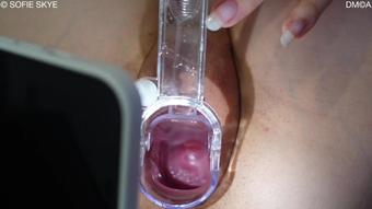 Playing Doctor With Stepbrother Speculum