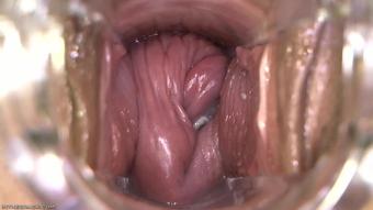 Inthecrack - 399 Sc04 You Got A Booger 1080P