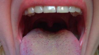 UVULA Deep Inside My MOUTH