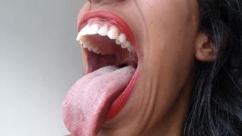 My huge mouth - July 04, 2019