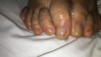 TOE CUM AND ASS SPREADING - December 31, 2024