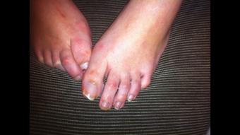 RAW NATURAL TOES LONG TOENAILS - PHOTO VIDEO - February 25, 2024