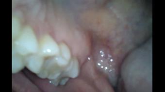 Janine & Tylee - Endoscope Mouth Tour