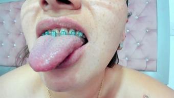Spit Fiend: Spit Addict