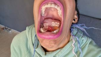 little helpless gummy bears vored - January 25, 2023
