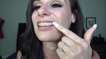 LAUREN'S BRACES & MOUTH TOUR 4K - August 04, 2023