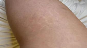 Stretch Mark Fetish 4K