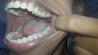 Teethy Mouth tour - June 12, 2021