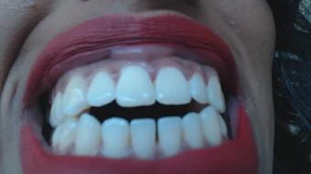 Big mouth shows off teeth - August 05, 2019