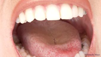 Exploring Danis Mouth Tongue  Throat - October 04, 2015