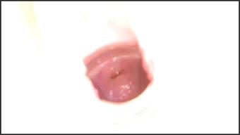 06Hd