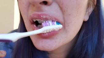 Tour Of Braces With Teeth Brushing