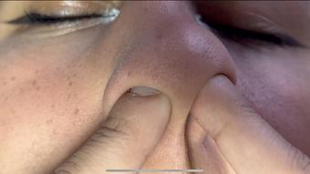 i like to put my fingers deep inside my nostrils, nose party - May 07, 2023