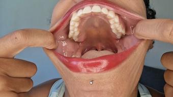 Mouth tour III - July 31, 2022