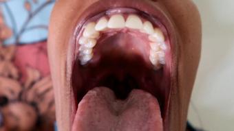 Unwanted Vore - September 10, 2022