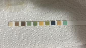 Nurse Gets Urinalysis