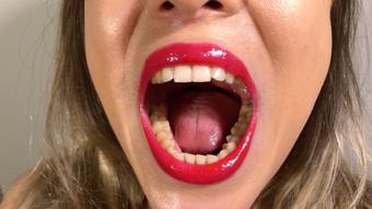 Dental Examination
